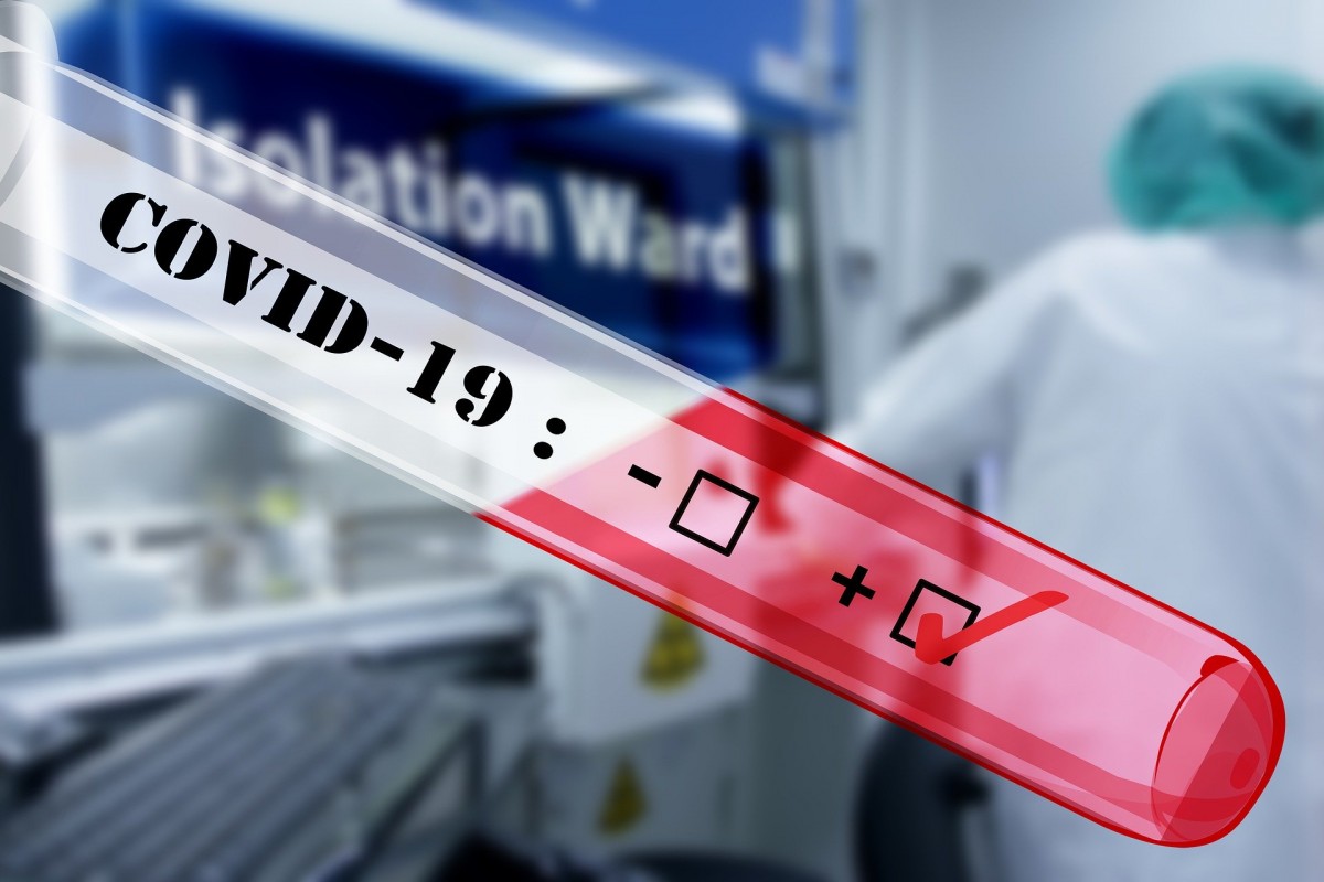 COVID-19: capacitatea de testare la Cluj va creşte la aproximativ 700 de probe pe zi