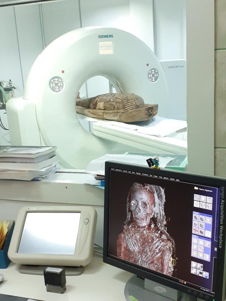 Proiect inedit la Cluj: investigare imagistică a unei mumii din Egiptul Antic