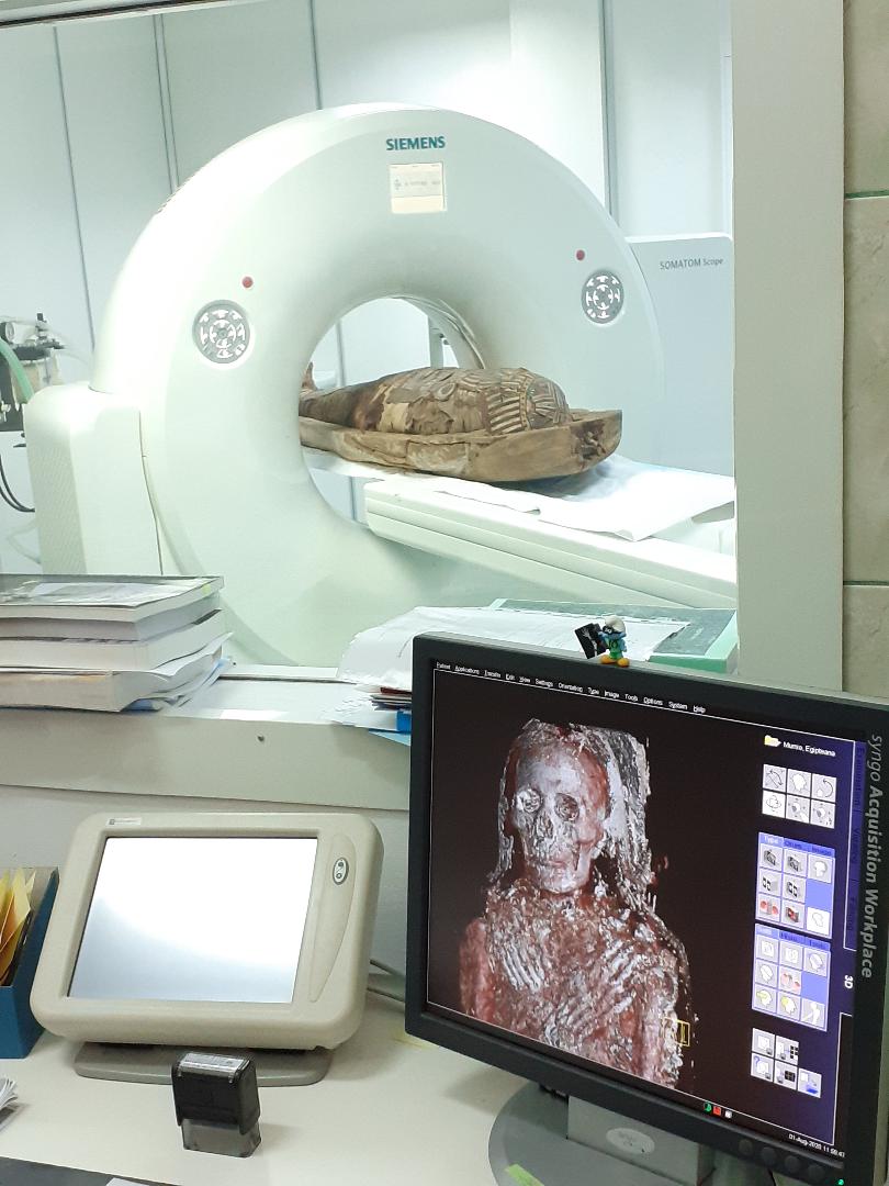 Proiect inedit la Cluj: investigare imagistică a unei mumii din Egiptul Antic