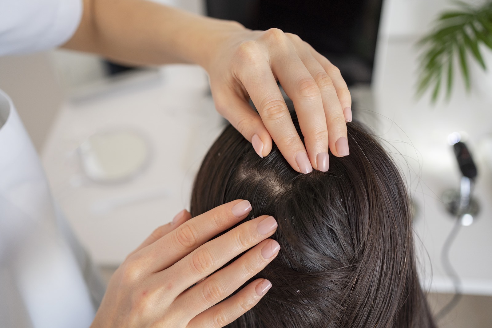 alopecie