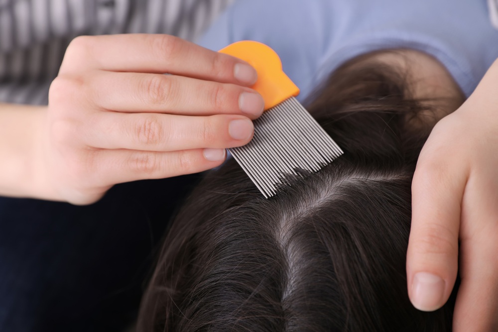 Cum să alegi cel mai eficient pieptene pentru păduchi 2 Pieptene pentru paduchi